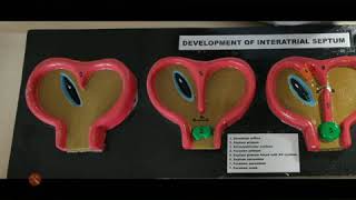 Development of interatrial septum exam model important [upl. by Ahseniuq]