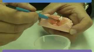 Dentsply Sirona Repair Material [upl. by Dang]