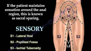 Sacral Sparing  Everything You Need To Know  Dr Nabil Ebraheim [upl. by Ardrey493]