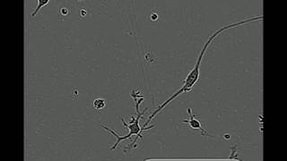 Cell Motility of Microglia Cultured in TIC [upl. by Nnaarual]