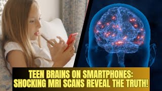 Teen Brains on Smartphones Shocking MRI Scans Reveal the Truth  Most Viral Today [upl. by Ramor515]