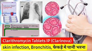 Clarithromycin 500 mg what is it used for hindi  Treatment of Pneumonia and Lungs infection [upl. by Valiant]