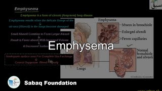 Emphysema Biology Lecture  Sabaqpk [upl. by Thanasi]