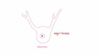 Rabies  Pathogenesis Clinical Presentation and Diagnosis [upl. by Saticilef94]