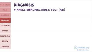 Peripheral Artery Disease  Osmosis [upl. by Attaynik312]