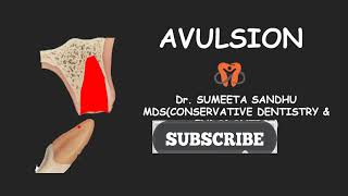 TOOTH AVULSION MANAGEMENT [upl. by Eilahs232]