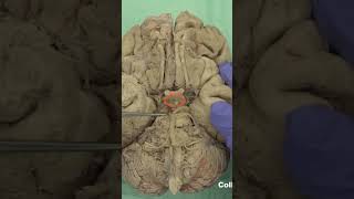 Ventral aspect of hypothalamus anatomy neuroanatomyhypothalamusbrainbrainanatomy [upl. by Yeslehc]