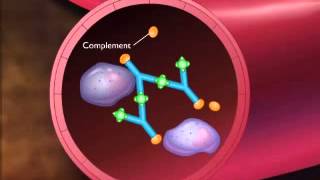 Immune Complex Type III hypersensitivity [upl. by Giah]