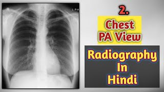 CHEST PA VIEW EXPLAINED IN HINDI  CHEST PA VIEW  CHEST RADIOGRAPHY [upl. by Adnoraj]