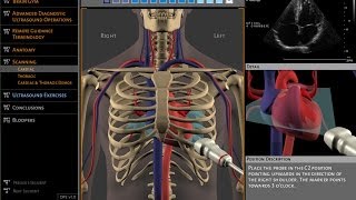 Basics of ultrasound machine [upl. by Inaffyt]