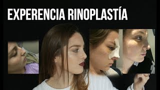 ME OPERÉ LA NARIZ FOTOS  MI EXPERIENCIA CON LA RINOPLASTÍA [upl. by Eniawd]