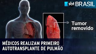 Médicos realizam primeiro autotransplante de pulmão em São Paulo  SBT Brasil 180723 [upl. by Cammi293]