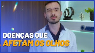 DOENÇAS que AFETAM os OLHOS  Fique de Olho  Dr Tiago César [upl. by Camfort]