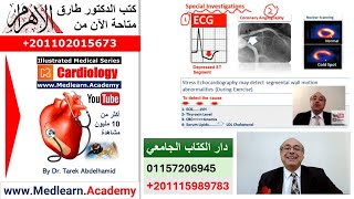 Angina Pectoris cme internalmedicine ecg usmle medical محاضراتباطنة [upl. by Enicnarf]