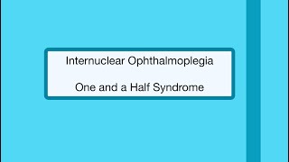 Internuclear Ophthalmoplegia  One and a Half Syndrome 👁 [upl. by Ihtac581]