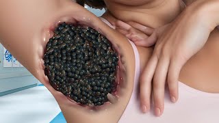 ASMR Dongla Armpit Treatment  ASMR Remove Gandul Maggots from Armpit  ASMR mashi [upl. by Angeline]