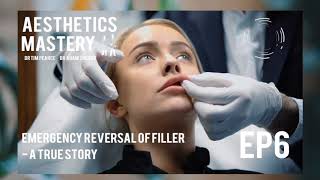 Emergency Reversal of Dermal Filler A True Story  Aesthetics Mastery podcast ep 6 [upl. by Akenn]