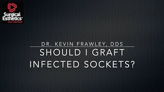 Should I Graft Infected Extraction Sockets [upl. by Slade361]