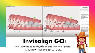 Invisalign GO ClinCheck amp case analysis [upl. by Dranyar432]