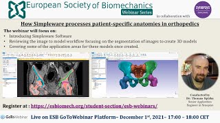 ESB Webinar Series – No 9 – How Simpleware processes patientspecific anatomies in orthopedics [upl. by Adina]