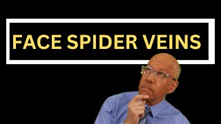 How to Treat Spider Veins on the Face 5 Essential Facts for Doctors and Nurses [upl. by Asenad]