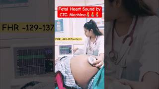 fetal heart sound by CTG machineroutine care [upl. by Atekahs105]