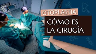 Cómo es la operación de otoplastia [upl. by Melak]