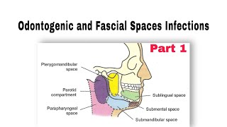 Odontogenic and Fascial Spaces Infections طب الأسنان مرحلة رابعة oralsurgery [upl. by Godfree838]