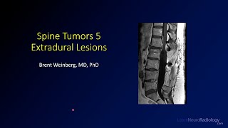 Spine tumors 5 – Extradural Lesions [upl. by Inahpets]