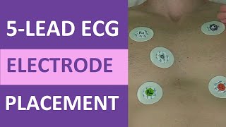 5 Lead ECG Placement of Electrodes EKG NCLEX amp Nursing Mnemonic [upl. by Mosnar]