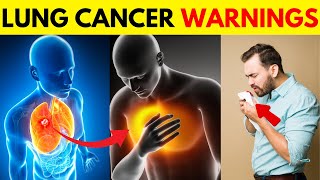 Early Warning Signs of Lung Cancer NEVER IGNORE THIS [upl. by Paule]