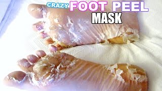 I TESTED A CRAZY FOOT PEEL MASK [upl. by Flaherty]