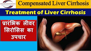 Treatment of liver cirrhosis  chronic liver disease  compensated cirrhosis [upl. by Mathias]