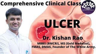 Ulcer Case Presentation [upl. by Malina832]