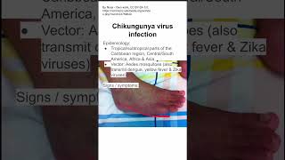 Chikungunya virus infection [upl. by Jacobson976]