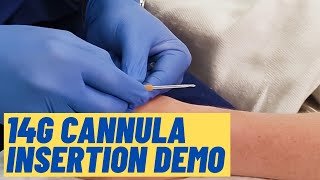 Large 14G cannula insertion technique  Live Demo [upl. by Matthias]