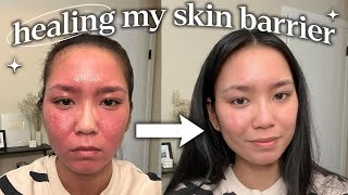 how i repaired my skin barrier not sponsored [upl. by Ahsot]