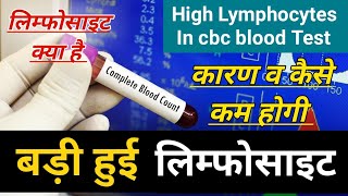 High Lymphocytes In Blood Test Causes Treatment  high lymphocytes in hindi लिम्फोसाइट्स क्या है [upl. by Pirnot]