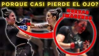 EXPERTO en la MMA habla  ¿Qué pasará con el OJO de Irene Aldana [upl. by Evangeline]