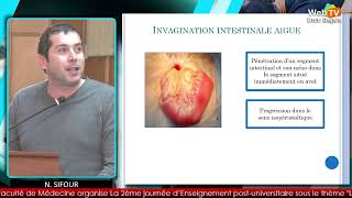 Occlusion intestinale aigue  diagnostic et traitement N SIFOUR D BENAIBOUCHE [upl. by Sakovich]