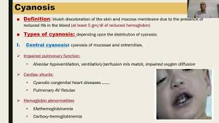 General examination Pallor and Cyanosis [upl. by Pohsib]