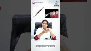 What is Operculectomy  Siri Dental Hospital  Best Dental Hospital  Invisalign Hyderabad [upl. by Joice955]