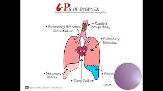 Pathophysiology and Management [upl. by Sihunn]