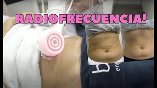 RADIOFRECUENCIA RESISTIVA 💪🏻Qué es Cómo funciona 😱 [upl. by Wendel]