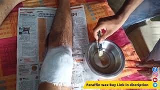 what is a paraffin bath physical therapy paraffin wax Treatment at home physiotherapy wax benefits [upl. by Essilevi413]