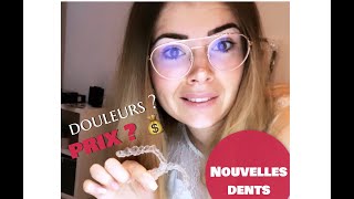 MON EXPÉRIENCE INVISALIGN 🦷  PRIX DOULEURS [upl. by Alane606]