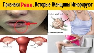 5 Важных Признаков РАКА Которые Не Следует Игнорировать Женщинам [upl. by Dolph]