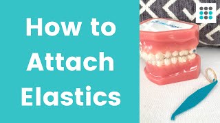 HOW TO PUT ELASTICS ON CLEAR ALIGNERS l Dr Melissa Bailey [upl. by Thormora]