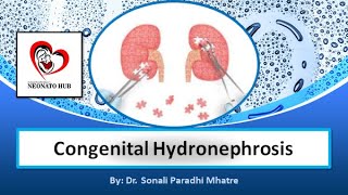 Congenital Hydronephrosis [upl. by Eineeuq]