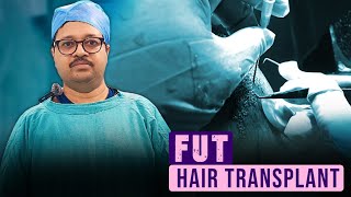 FUT Hair Transplant Surgery by Dr Jayanta Bain Plastic amp Cosmetic Surgeon [upl. by Audwen700]